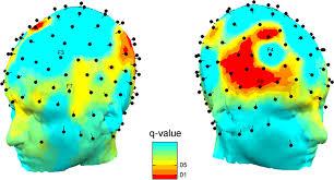 prefrontale assymetrie reclame hersenen neuromarketing
